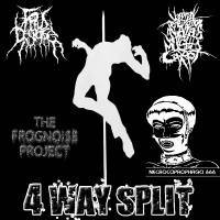 Fetus Disease : 4 Way Split